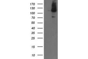 Western Blotting (WB) image for anti-Excision Repair Cross-Complementing Rodent Repair Deficiency, Complementation Group 4 (ERCC4) antibody (ABIN1498071) (ERCC4 anticorps)