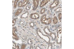 Immunohistochemical staining (Formalin-fixed paraffin-embedded sections) of human kidney with SHOC2 polyclonal antibody  shows moderate cytoplasmic positivity in cells in tubules. (SHoc2/Sur8 anticorps  (AA 455-562))