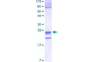 Image no. 1 for Tumor Necrosis Factor (Ligand) Superfamily, Member 18 (TNFSF18) (AA 50-177) protein (His-DYKDDDDK-Strep II Tag) (ABIN1323240)