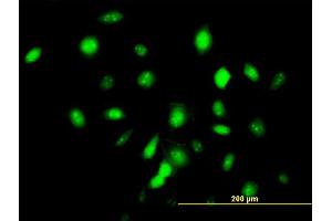 Immunofluorescence of monoclonal antibody to ID3 on HeLa cell. (ID3 anticorps  (AA 1-83))