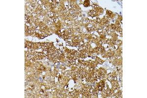 Immunohistochemistry of paraffin-embedded rat liver using Septin 4 antibody (ABIN6128476, ABIN6147554, ABIN6147555 and ABIN6214410) at dilution of 1:100 (40x lens). (Septin 4 anticorps  (AA 1-100))