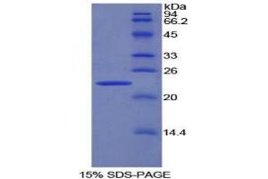 SDS-PAGE analysis of Rat Pronociceptin Protein. (Pronociceptin Protéine)
