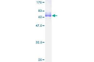SDS-PAGE (SDS) image for Mesenchyme Homeobox 2 (MEOX2) (AA 1-303) protein (GST tag) (ABIN1781086)