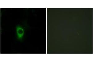 Immunofluorescence analysis of HeLa cells, using 5-HT-2B Antibody.