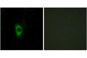 Immunofluorescence analysis of HeLa cells, using 5-HT-2B Antibody. (Serotonin Receptor 2B anticorps  (AA 261-310))