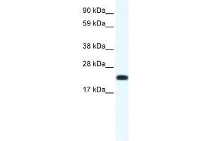 WB Suggested Anti-CITED4 Antibody Titration:  1. (CITED4 anticorps  (N-Term))