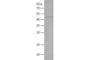 Western Blotting (WB) image for Reticulocalbin 2, EF-Hand Calcium Binding Domain (RCN2) (AA 26-317) protein (His tag) (ABIN7124834)