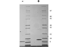SDS-PAGE of Mouse Interleukin-15 Recombinant Protein SDS-PAGE of Mouse Interleukin-15 Recombinant Protein. (IL-15 Protéine)