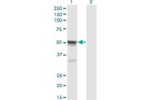 Western Blot analysis of CASQ2 expression in transfected 293T cell line by CASQ2 monoclonal antibody (M01), clone 1B6. (CASQ2 anticorps  (AA 20-399))