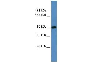 WB Suggested Anti-Hps3 Antibody Titration:  0. (HPS3 anticorps  (N-Term))