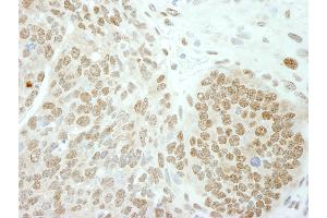 Immunohistochemistry (IHC) image for anti-Polymerase (DNA Directed), epsilon 3 (p17 Subunit) (POLE3) (AA 97-147) antibody (ABIN7448733)
