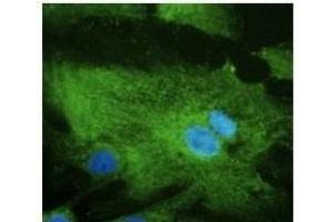 Anti-Rabll Ab at 1/500 dilution, Hepa cell line lysates at 100 µg per Iane, rabbit polyclonal to goat lµg (HRP) at 1/10,000 dilution,