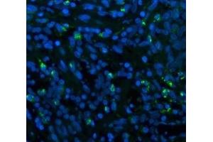 IF analysis of CD68 using anti-CD68 antibody (ABIN7600142). (CD68 anticorps  (AA 154-354))