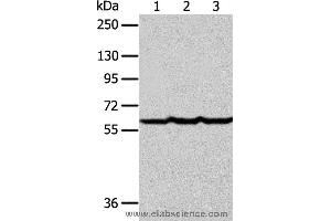 Western blot analysis of Human liver cancer tissue, hela and Jurkat cell , using F9 Polyclonal Antibody at dilution of 1:400 (Coagulation Factor IX anticorps)