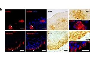 Expression patterns of vimentin, α-SMA, and P311 in the epidermis of human burn wounds. (NREP anticorps  (AA 25-68))