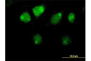 Immunofluorescence of purified MaxPab antibody to ZBTB26 on HeLa cell. (ZBTB26 anticorps  (AA 1-441))