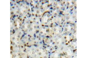 Used in DAB staining on fromalin fixed paraffin-embedded Kidney tissue (PIN1 anticorps  (AA 2-163))