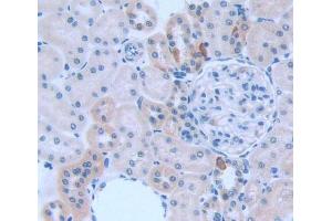 Used in DAB staining on fromalin fixed paraffin- embedded kidney tissue