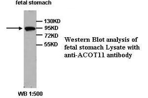 Image no. 1 for anti-Acyl-CoA Thioesterase 11 (ACOT11) (Internal Region) antibody (ABIN791080) (ACOT11 anticorps  (Internal Region))