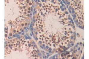 Detection of CA5B in Mouse Testis Tissue using Polyclonal Antibody to Carbonic Anhydrase VB, Mitochondrial (CA5B)