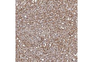 IHC analysis of TRMT61A using anti-TRMT61A antibody (ABIN7599220). (TRMT61A anticorps  (AA 1-289))