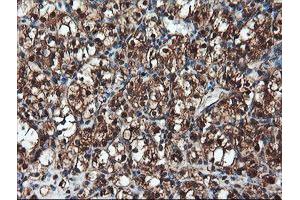 Image no. 10 for anti-Proteasome Subunit alpha 6 (PSMA6) antibody (ABIN1500465)