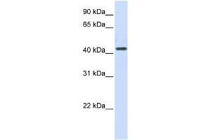 HSD3B2 antibody used at 1 ug/ml to detect target protein. (HSD3B2 anticorps  (N-Term))