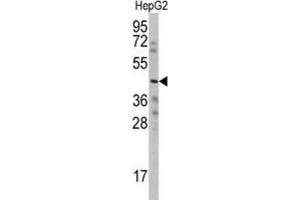 Western Blotting (WB) image for anti-Wnt1 Inducible Signaling Pathway Protein 3 (WISP3) antibody (ABIN3002571) (WISP3 anticorps)