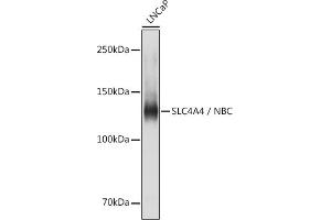 Western blot analysis of extracts of LNCaP cells, using SLC4 / NBC antibody (ABIN6129130, ABIN6148013, ABIN6148014 and ABIN6220962) at 1:1000 dilution. (SLC4A4 anticorps  (AA 1-240))