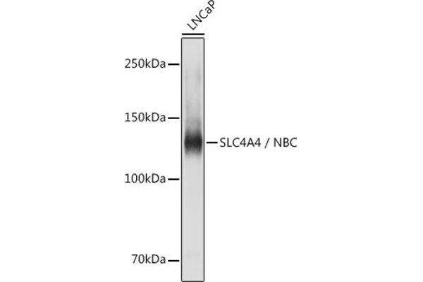SLC4A4 Antikörper  (AA 1-240)