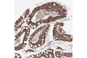 Immunohistochemical staining of human small intestine with TMPRSS11F polyclonal antibody  strong cytoplasmic positivity in glandular cells at 1:50-1:200 dilution. (TMPRSS11F anticorps)