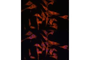 Immunofluorescence analysis of HeLa cells using Legumain (Legumain (LGMN)) Polyclonal Antibody (ABIN6128201, ABIN6143172, ABIN6143173 and ABIN6214867) at dilution of 1:100 (40x lens).