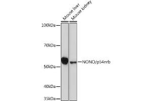 Western blot analysis of extracts of various cell lines, using NONO/p54nrb Rabbit mAb (ABIN7268947) at 1:1000 dilution. (NONO anticorps)