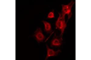 ABIN6266877 staining Hela by IF/ICC. (DMPK anticorps  (N-Term))