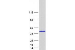 Validation with Western Blot