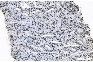 IHC analysis of FOXK1 using anti-FOXK1 antibody (ABIN7600295). (Foxk1 anticorps  (AA 175-671))