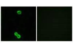 Immunofluorescence analysis of MCF-7 cells, using RPL3L antibody. (RPL3L anticorps)