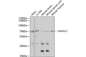Western blot analysis of extracts of various cell lines, using V antibody (ABIN6132779, ABIN6150054, ABIN6150055 and ABIN6223794) at 1:1000 dilution. (VANGL2 anticorps  (AA 1-110))