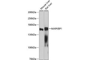 Western blot analysis of extracts of various cell lines, using M antibody (ABIN3016334, ABIN3016335, ABIN5664104 and ABIN6219724) at 1:1000 dilution. (MAPKBP1 anticorps  (AA 1-100))