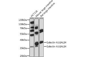 Western blot analysis of extracts of various cells, using Galectin 4/LG antibody (ABIN7267339) at 1:1000 dilution. (GAL4 anticorps  (AA 1-100))