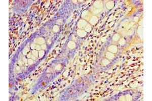 Immunohistochemistry of paraffin-embedded human colon tissue using ABIN7162957 at dilution of 1:100 (EHHADH anticorps  (AA 1-723))