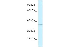 Western Blot showing ALKBH1 antibody used at a concentration of 1 ug/ml against Fetal Kidney Lysate