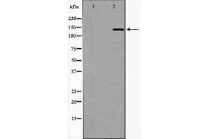 Western blot analysis of extracts of Jurkat, using DCTN1 antibody. (Dynactin 1 anticorps  (C-Term))