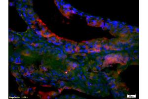 Formalin-fixed and paraffin-embedded rat testis labeled with Anti--EphA7/Eph receptor A7 Polyclonal Antibody, Unconjugated (ABIN722005) 1:200, overnight at 4°C, The secondary antibody was Goat Anti-Rabbit IgG, Cy3 conjugated used at 1:200 dilution for 40 minutes at 37°C.