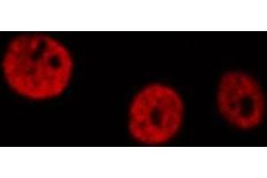 ABIN6266915 staining HeLa  cells by IF/ICC.