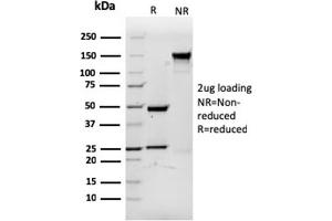 SDS-PAGE Analysis Purified CD3eRecombinant Mouse Monoclonal Antibody (rC3e/1931).