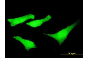 Immunofluorescence of monoclonal antibody to SYNE2 on HeLa cell. (SYNE2 anticorps  (AA 6702-6799))