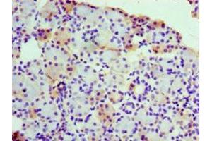 Immunohistochemistry of paraffin-embedded human pancreatic tissue using ABIN7142800 at dilution of 1:100 (RPL3 anticorps  (AA 1-115))