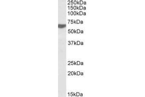AP20110PU-N RAP1 antibody staining of Human Tonsil lysate at 0. (RAP1 anticorps  (C-Term))