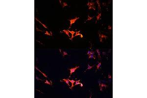 Immunofluorescence analysis of C6 cells using L Polyclonal Antibody (ABIN6133274, ABIN6143083, ABIN6143084 and ABIN6215309) at dilution of 1:100 (40x lens).
